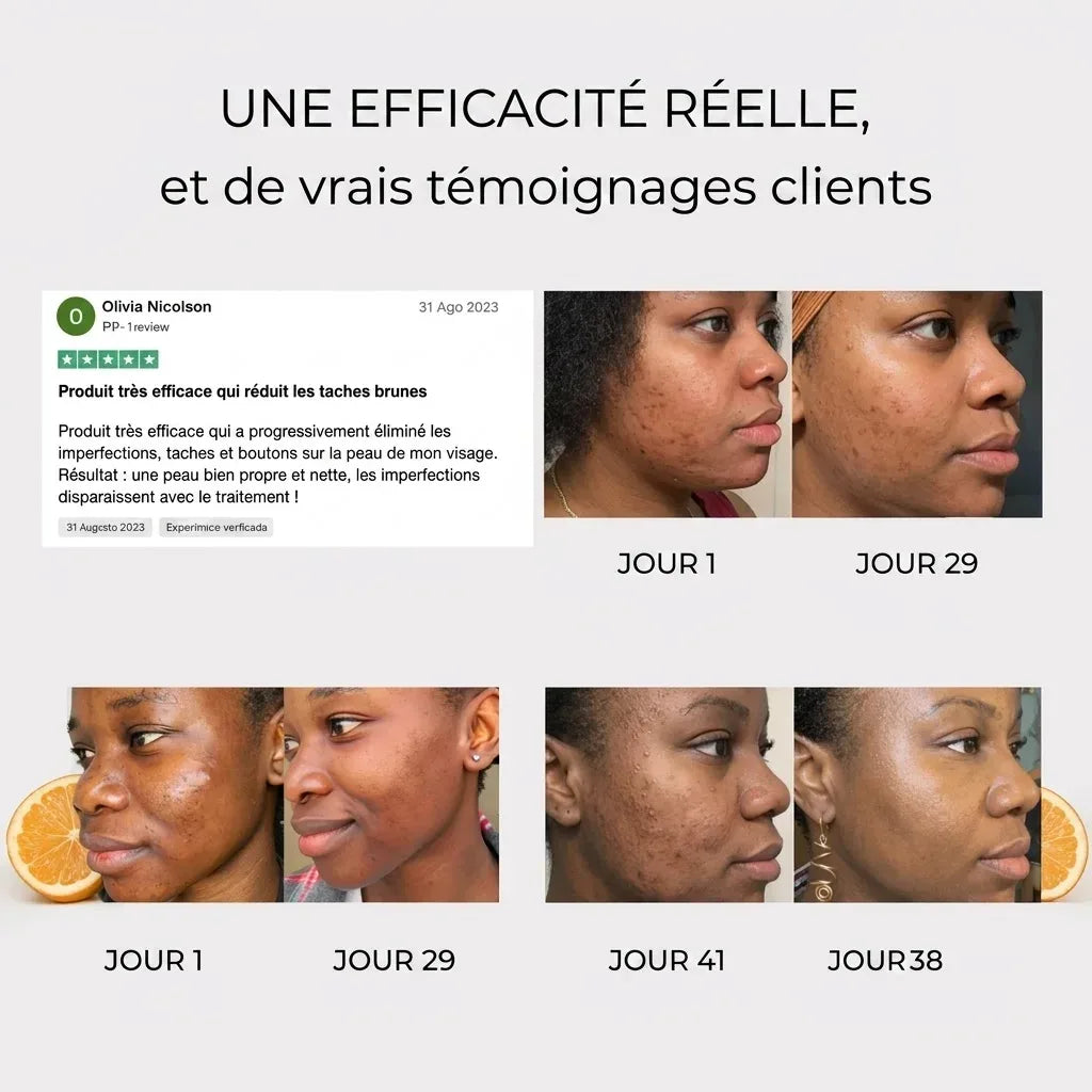 Pack complet anti imperfection au curcuma naturel